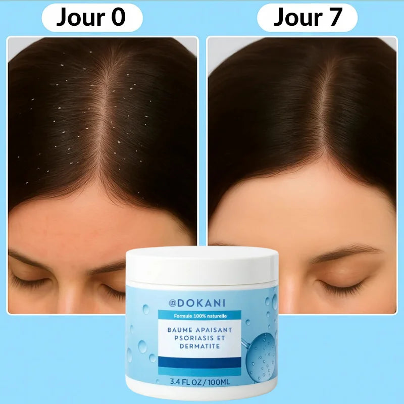 Baume apaisant psoriasis & dermatite
