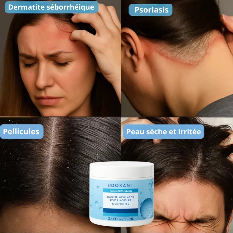 Baume apaisant psoriasis & dermatite