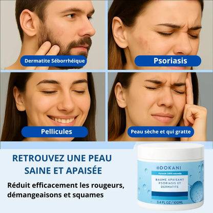Baume apaisant psoriasis & dermatite